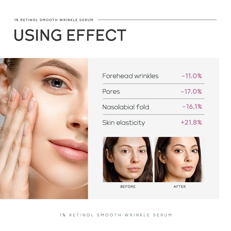Quiyum 1% Retinol Smooth Wrink - The Ordinary Serum Hyaluronic Acid recension och pris